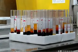 艾滋病患者的暮年，你不知道的世界！（很压抑）图片