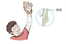 桡骨小头半脱位，你必须知道图片