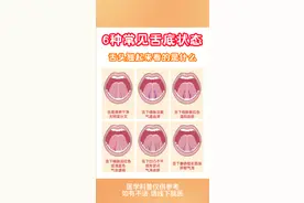 6种常见舌底状态图片