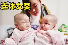 2009年湖北夫妻生连体怪婴，两人共用一个肛门，邻居都劝再生一个图片