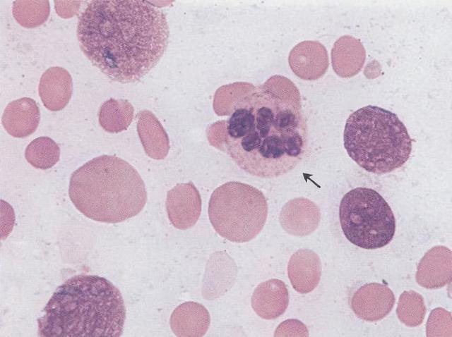 几块钱1瓶维生素B12，或许可以“摆平”这4种病，早了解早受益