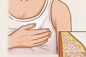 乳腺结节对哺乳有影响？原来答案竟是这样...图片
