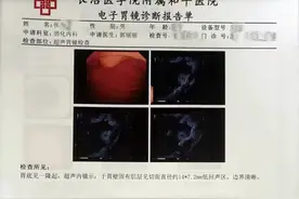 长治首例！长治医学院附属和平医院成功开展内镜下胃底间质瘤全层切除术图片