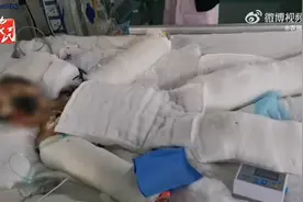 10岁女儿玩火碱重度烧伤单亲妈妈泪崩：女儿3岁时被确诊脑瘫图片