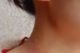 脖子上红了一片，老是瘙痒，经常反复，最近越来越大，越来越厚图片