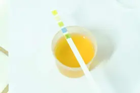 排尿时出现尿液颜色发黄的现象，或与这5个因素有关，需重视图片