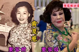 被整容毁掉的18位女星，曾经靓丽貌美如花，如今面部僵硬灵气全无图片