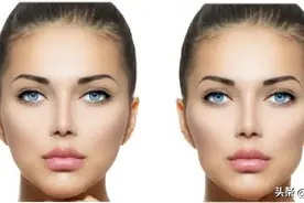 拯救“牙套脸”图片