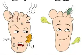 湿疹与脚气反反复复？一个方子两味中药，有效果图片