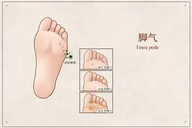 一到夏季脚气就瘙痒难忍，反复发作！记住这两点，根治脚气无烦恼图片