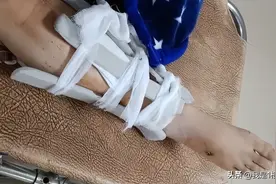 青岛女子被陌生人装GPS跟踪并打断腿，后续来了！图片