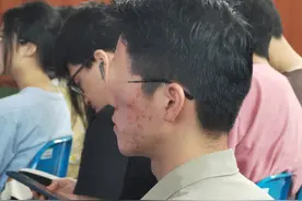 吃辣会“爆痘”？非也！ 戴口罩致暗疮？真的！图片