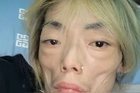 她被称为最惨阔太，曾瘦到44斤严重脱相遭丈夫抛弃，如今重获新生图片