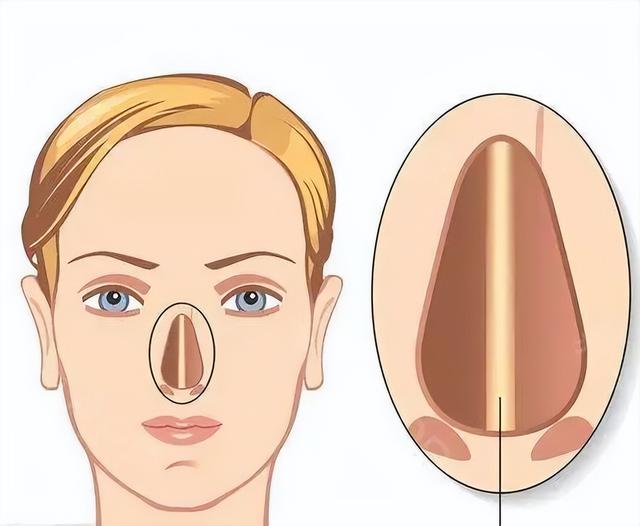 九院韦敏 | 鼻子歪除了不美观,还有其他影响吗?