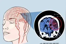 超级健康秘籍，57岁男子惊天逆袭，中老年人必看！图片