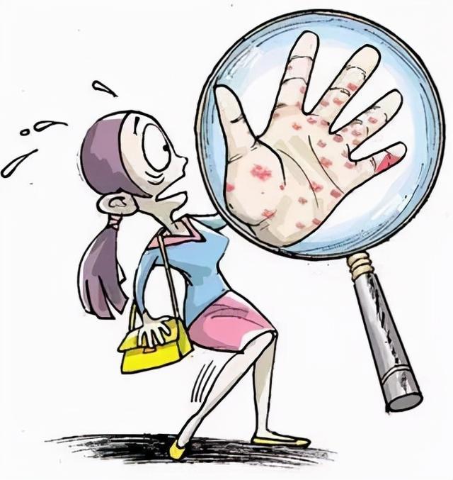 两颊毛囊角化症