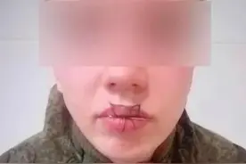 俄罗斯新兵给女友打电话发生了激烈争吵，事后把自己的嘴缝了起来图片