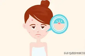 别让痘来扰｜痤疮的日常护理与治疗图片