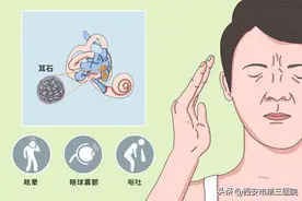 眩晕怪病｜耳朵里的“小石头”——耳石症图片