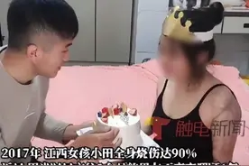 男子照顾烧伤女友6年，出事时才交往1个月，回应“6年还不结婚”争议：想等她伤疤恢复好点，希望她漂亮出嫁图片
