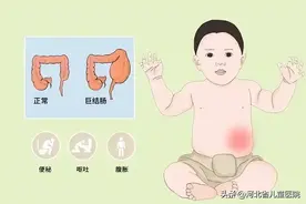 新生宝宝便秘，当警惕！图片