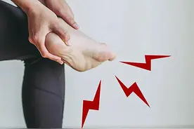足底疼痛，到底是足底筋膜炎还是骨刺，如何分辨？图片