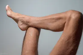 腹股沟区出现红斑，持续瘙痒！这种真菌感染实在太尴尬图片