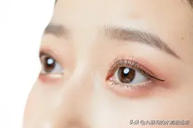 眼睛经常流泪是怎么回事？图片