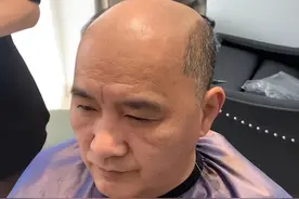 浙江宁波，老公秃顶老婆看着心烦，戴上假发又有危机感：男人真难图片