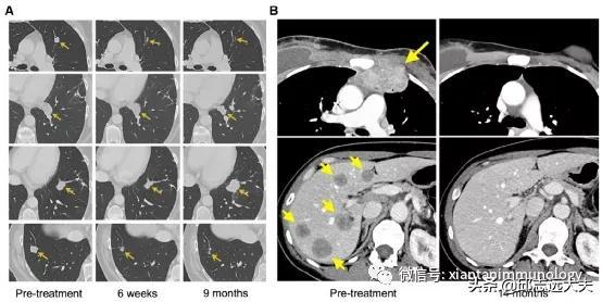 研究肿瘤必须知道的十一类肿瘤抗原