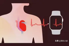 国行Apple Watch心电图来了~（附开通教程）图片