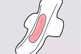 同房后出血是宫颈癌吗？图片