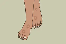 脚部出现7大表现，不要再误以为是衰老了，可能是疾病信号图片