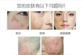 皮秒激光做多少次才有效果？图片