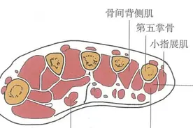 一针灵之手麻痛妙用后溪透劳宫图片
