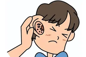 潍坊耳鼻喉专家分享耳痒怎么办？快速缓解耳痒的方法大揭秘！图片