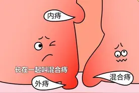 痔疮出血该如何处理？图片