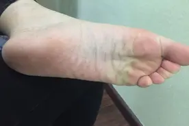 养生先看脚！脚上有4个特征，说明身体还不错，自查看一看图片