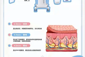 抗衰老仪器科普，什么是超声炮？图片
