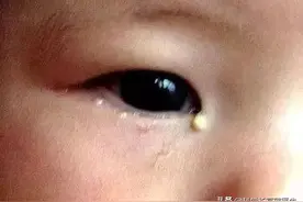 孩子咳嗽发烧总反复？根儿找错了！注意6大表现，3招就可改善！图片