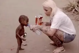 非洲2岁男孩被当作巫童，遭父母遗弃，流浪中遇游客喂水后被收养图片