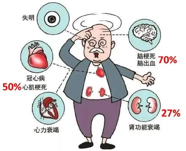 循环动脉压升高出现一系列以心血管综合征为主的临床表现,称为高血压