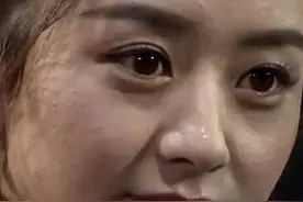 闭口一堆，坑坑洼洼，这5个女明星皮肤是真的差！图片