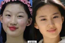 2016年，19岁的李奕霏斥资百万，只为整容成刘亦菲，如今怎么样了图片