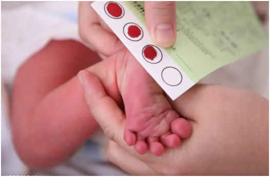 新生娃松软无力，一定做甲基化基因检测，可能是小胖威利综合征