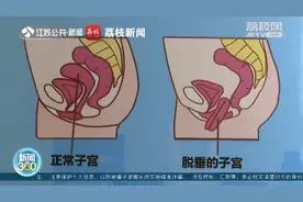 中国超3成已婚育女性有漏尿症状图片