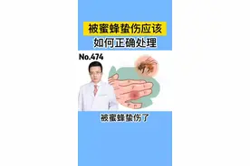 被蜜蜂蛰到了，很多人这一步做错！医生教你正确处理 #蜜蜂 #科普 #五一 #露营 #野餐 