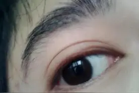单双眼皮的来历图片