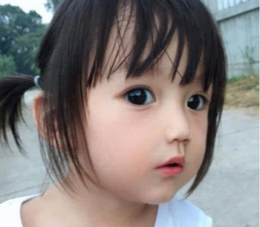 歌舞伎综合征:长得漂亮也是病,这种病产检都查不出来(歌舞伎面谱综合