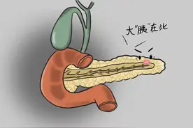 饮食不注意，易得胰腺炎！遵循7个饮食原则，胰腺才健康！图片